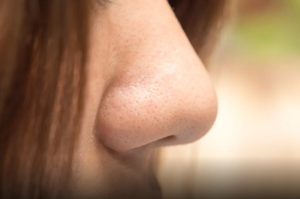 implante de nariz